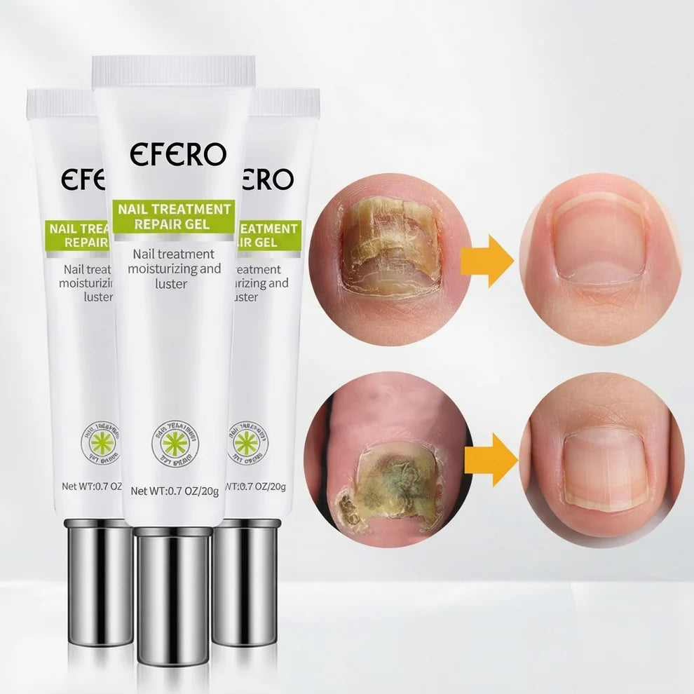 EFERO™ Advanced Anti-Fungal Nail Repair Gel